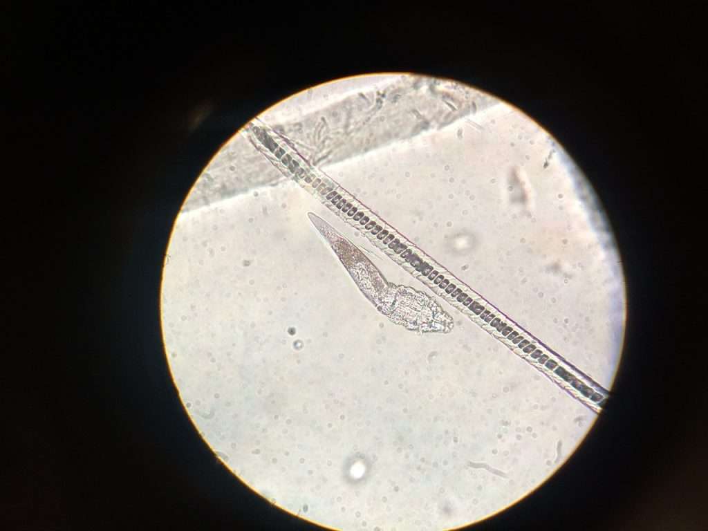 microscope, midd, hair follicle mite-1168472.jpg